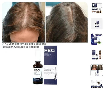 Hair Growth Spray 100% guaranteed