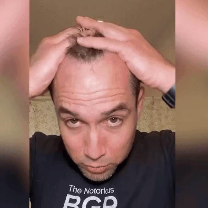 Hair Growth Spray 100% guaranteed